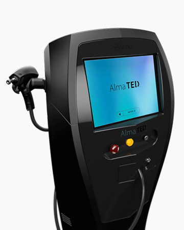alma-ted-non-surgical-treatment-1 Alma TED Laser Hair Restoration for Women at HT&RC