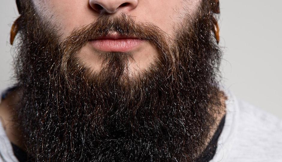 4 Reasons Beard Hair is a Great Option for Hair Transplants