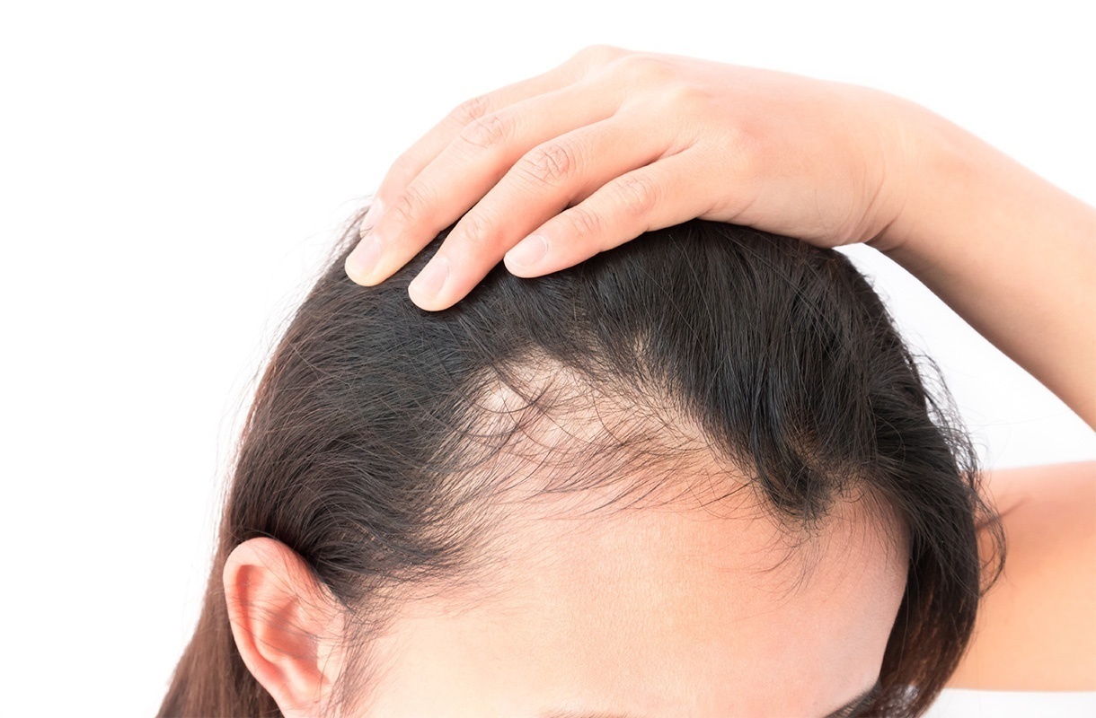 What Is a Scalp Biopsy and Why Do I need one?