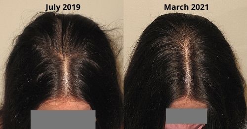 patient in march and july