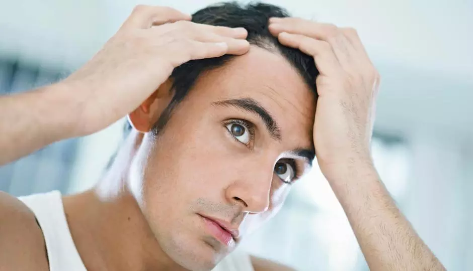 Classifications of Hair Loss Disorders