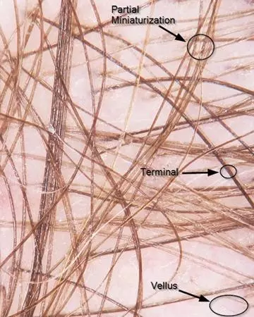 crown follicles