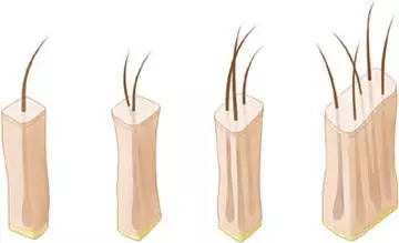 Trichoscope Exam: The Benefits Trichoscope Exam: The Benefits