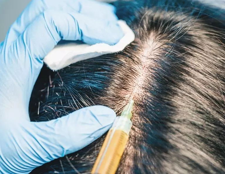 hair follicle regeneration for women