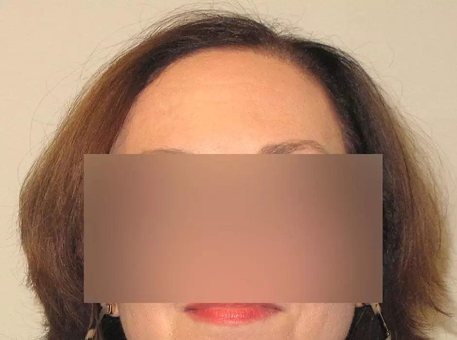 Click to enlarge image patient01f-01.jpg