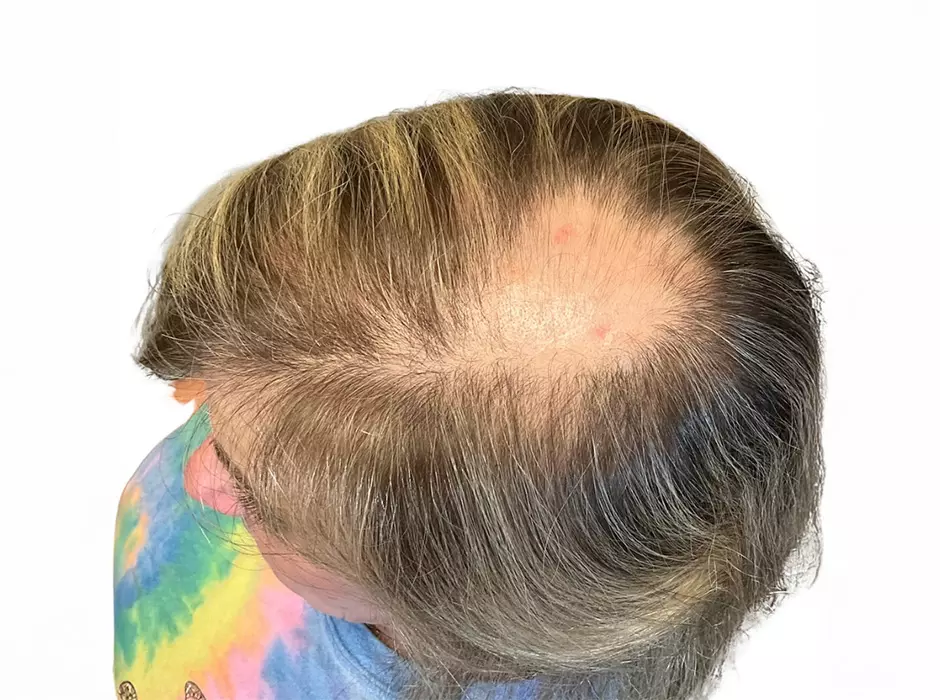 Click to enlarge image patient22f-01.jpg