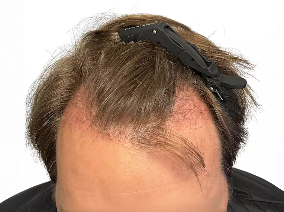 Click to enlarge image patient14m-01.jpg