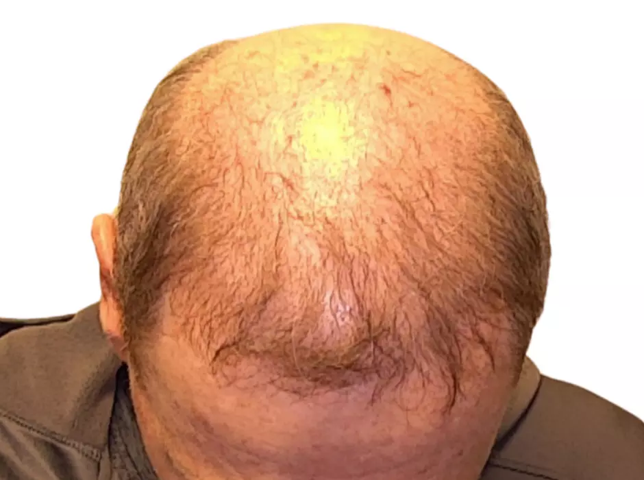 Click to enlarge image patient15m-01.jpg