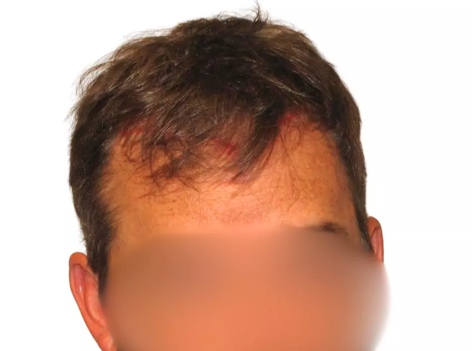 Click to enlarge image patient16m-01.jpg