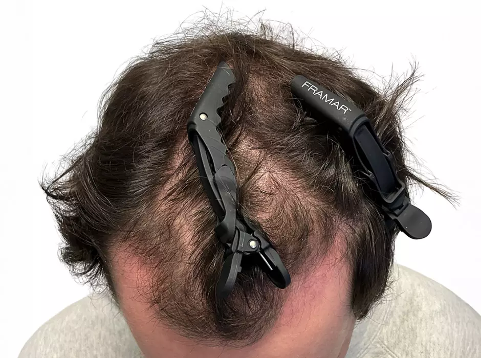 Click to enlarge image patient17m-01.jpg