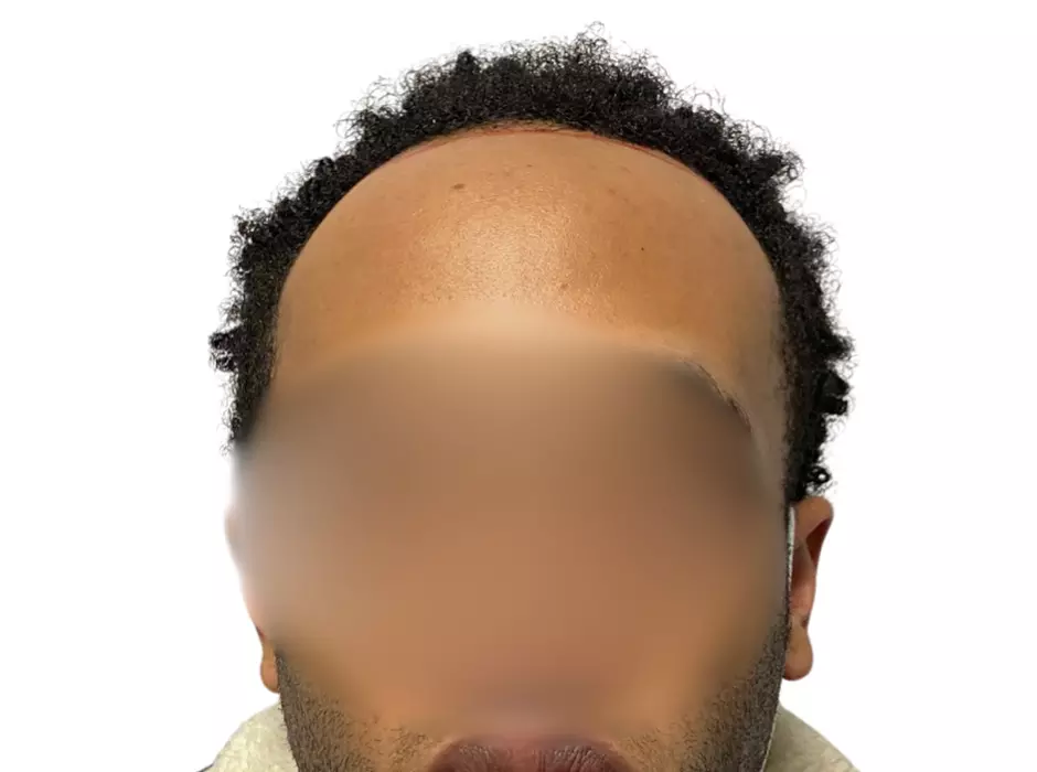 Click to enlarge image patient18m-01.jpg