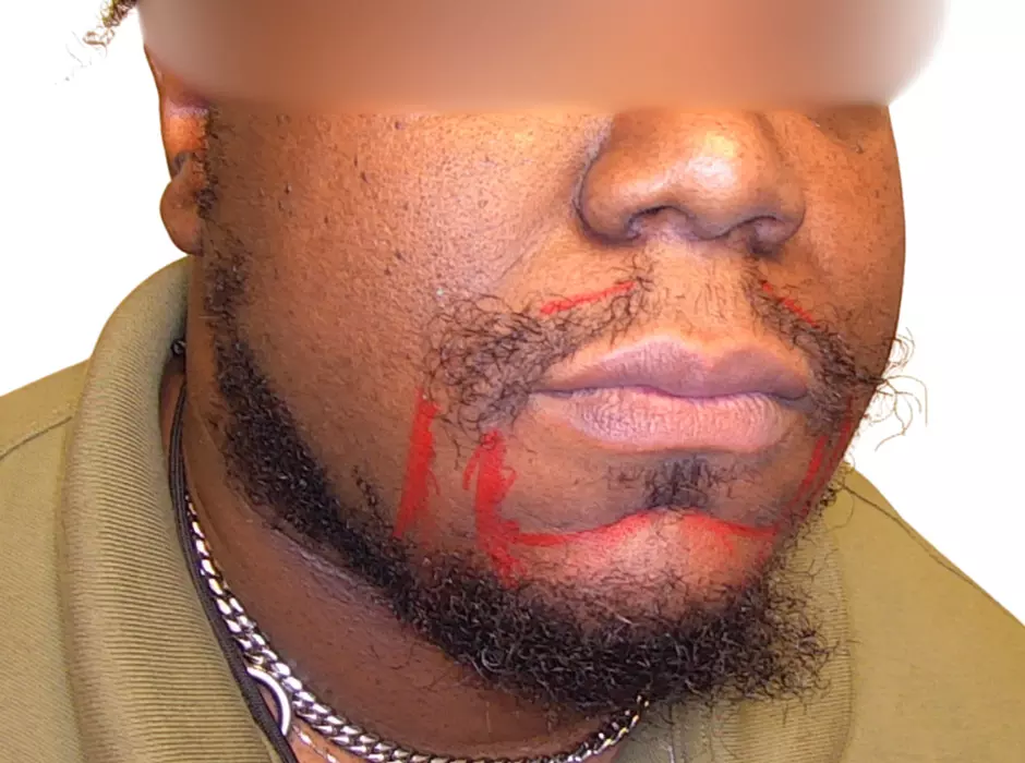 Click to enlarge image patient19m-01.jpg