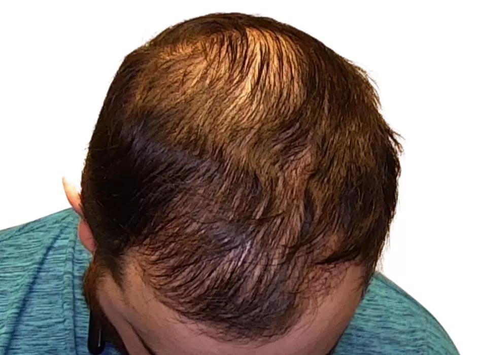 Click to enlarge image patient20m-01.jpg